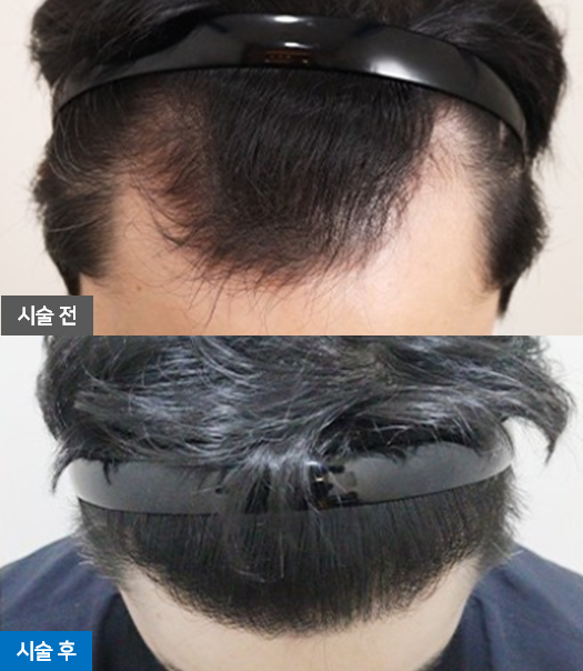 이벤트 안내 1