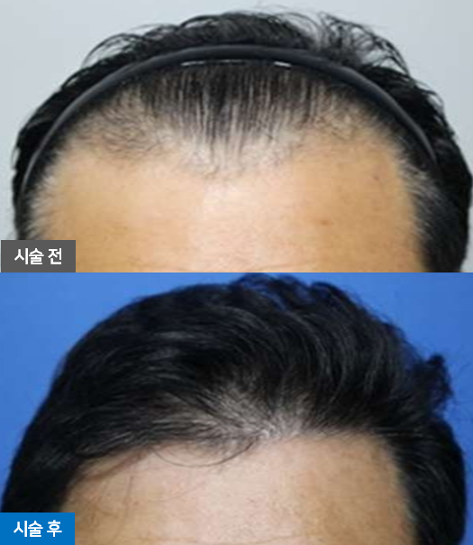 이벤트 안내 2